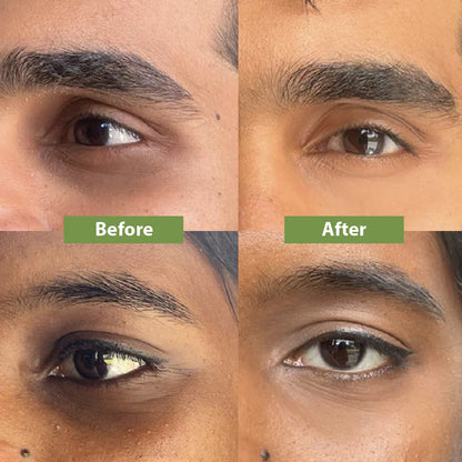 Eye Bright Corrector | SkinFushion Formula